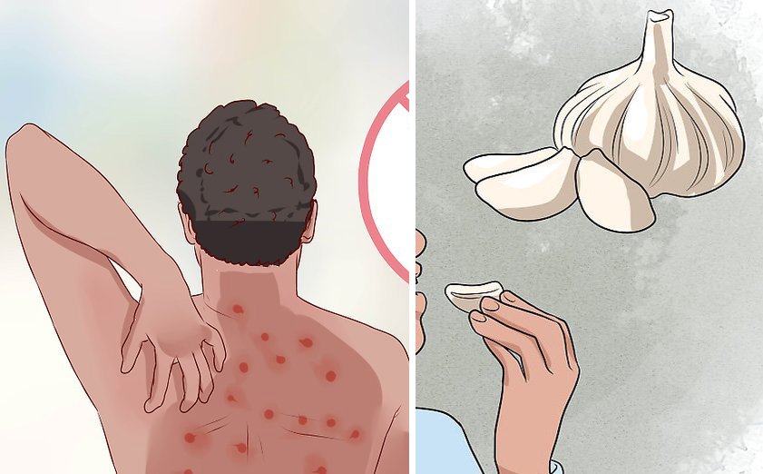 Cómo detectar si tienes alergia al ajo y cuáles son los signos