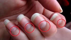 Cambios en las uñas que te muestran problemas de salud