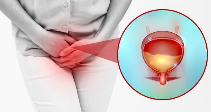 Si sufres de incontinencia urinaria estas son 6 maneras de pararla